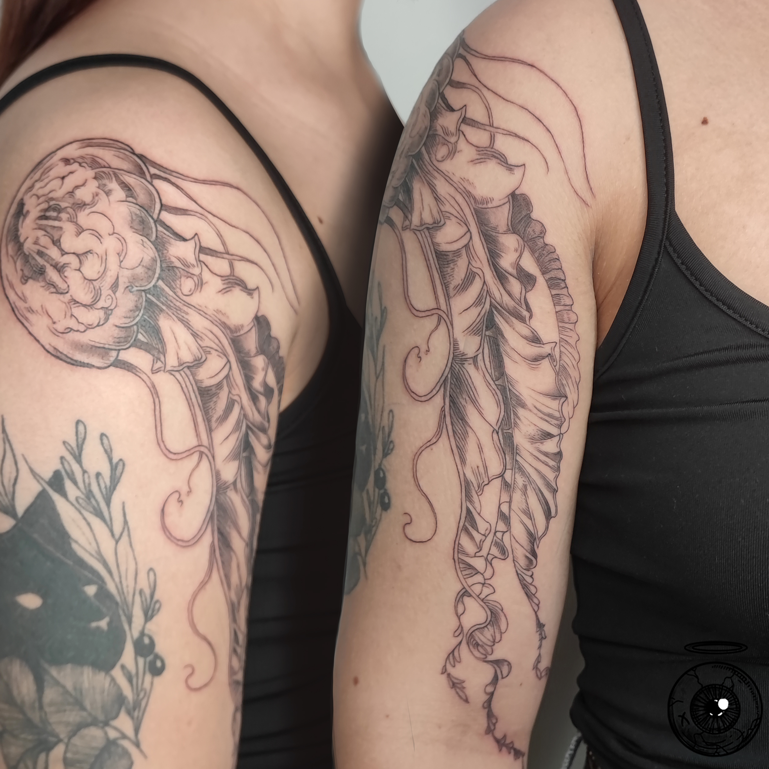 Medusa